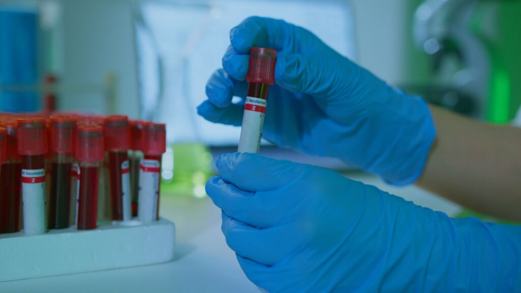 Dłonie w rękawiczkach trzymają probówki z krwią w laboratorium