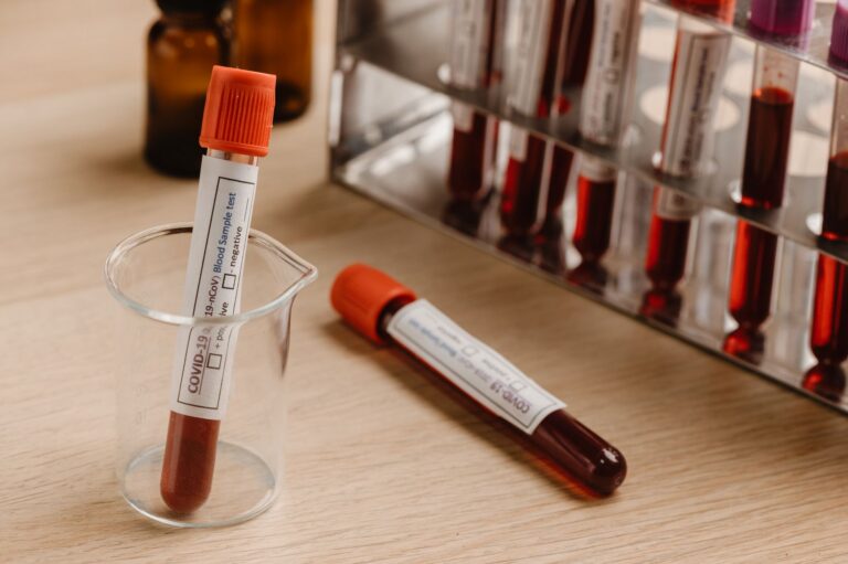 Probówki z próbkami krwi do badań laboratoryjnych